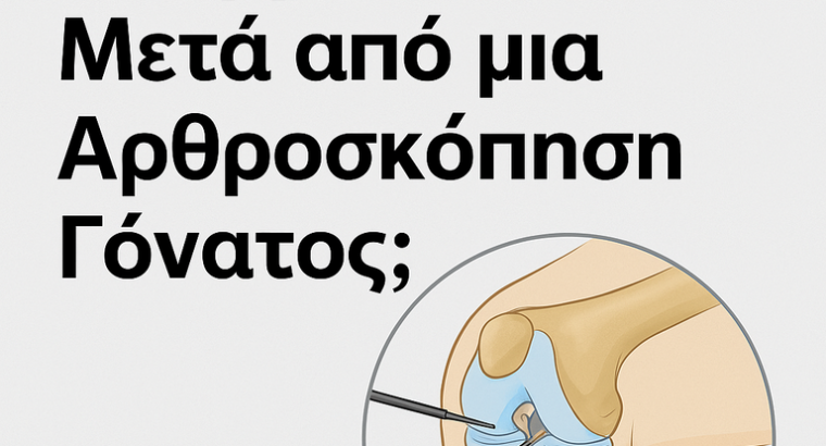 Πόσο Διαρκεί η Ανάρρωση Μετά από μια Αρθροσκόπηση Γόνατος;